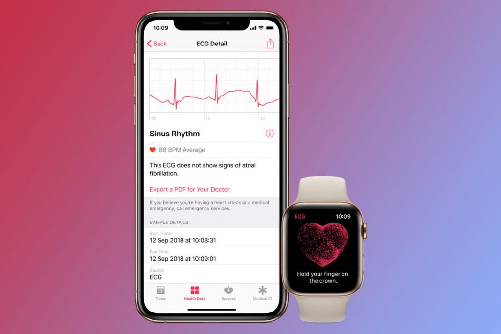 How to read the ECG results on your iPhone